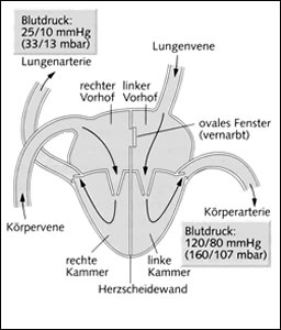 Das menschliche Herz besteht aus zwei funktionell unabhängigen Pumpsystemen, dem rechten und dem linken Herz. 