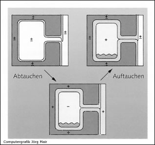 Barotrauma der Nasennebenhöhlen